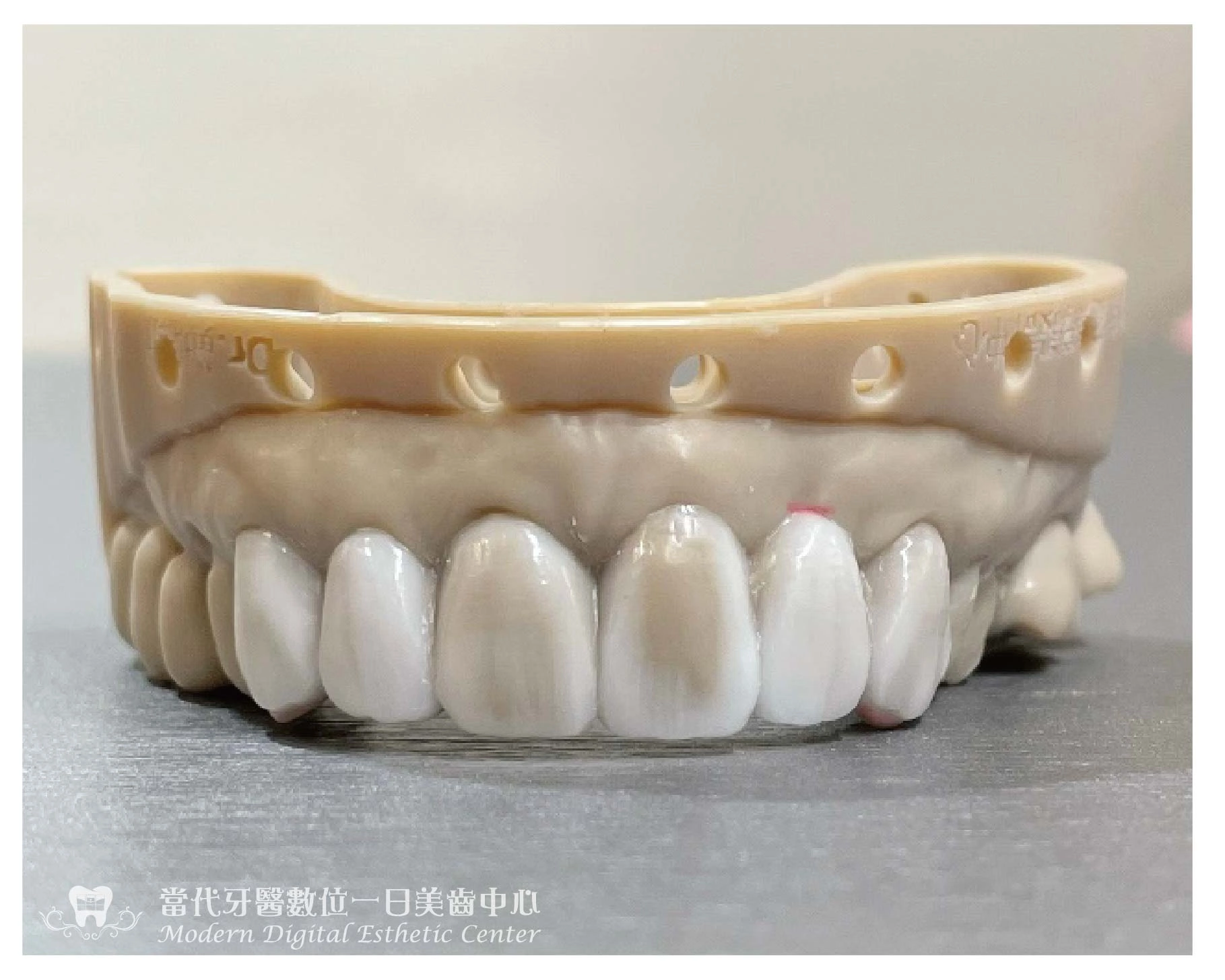 拆舊貼片-我適合陶瓷貼片嗎 拆舊貼片-我適合陶瓷貼片嗎