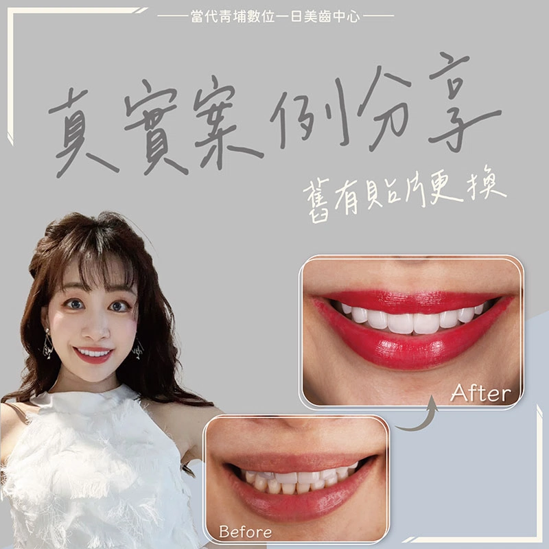 拆舊貼片-案例1