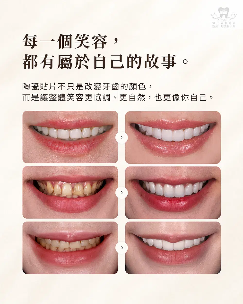 🎉【十週年專案】把想了很久的笑容，留在今年！🎉