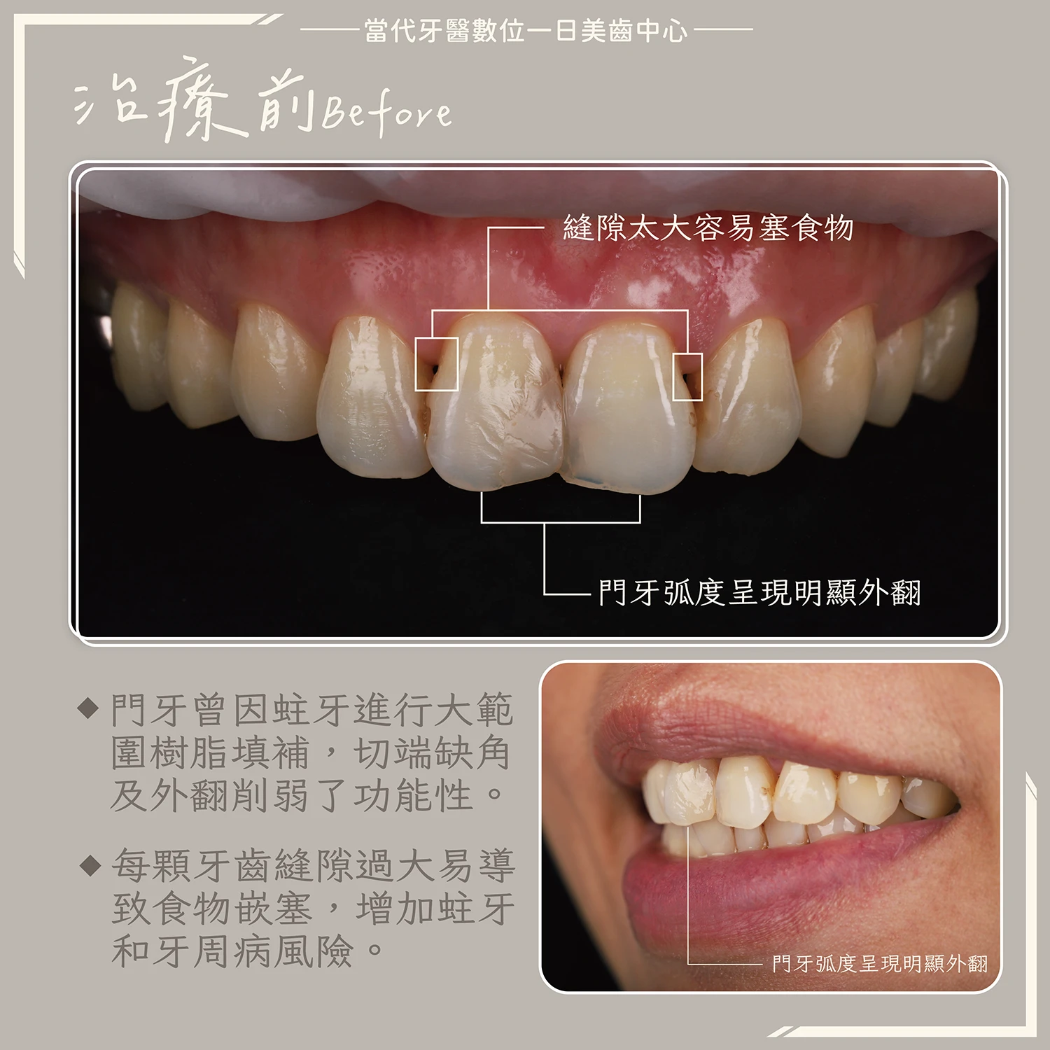 proimages/in-pro/pro-02/case-03.jpg proimages/in-pro/pro-02/case-03.jpg