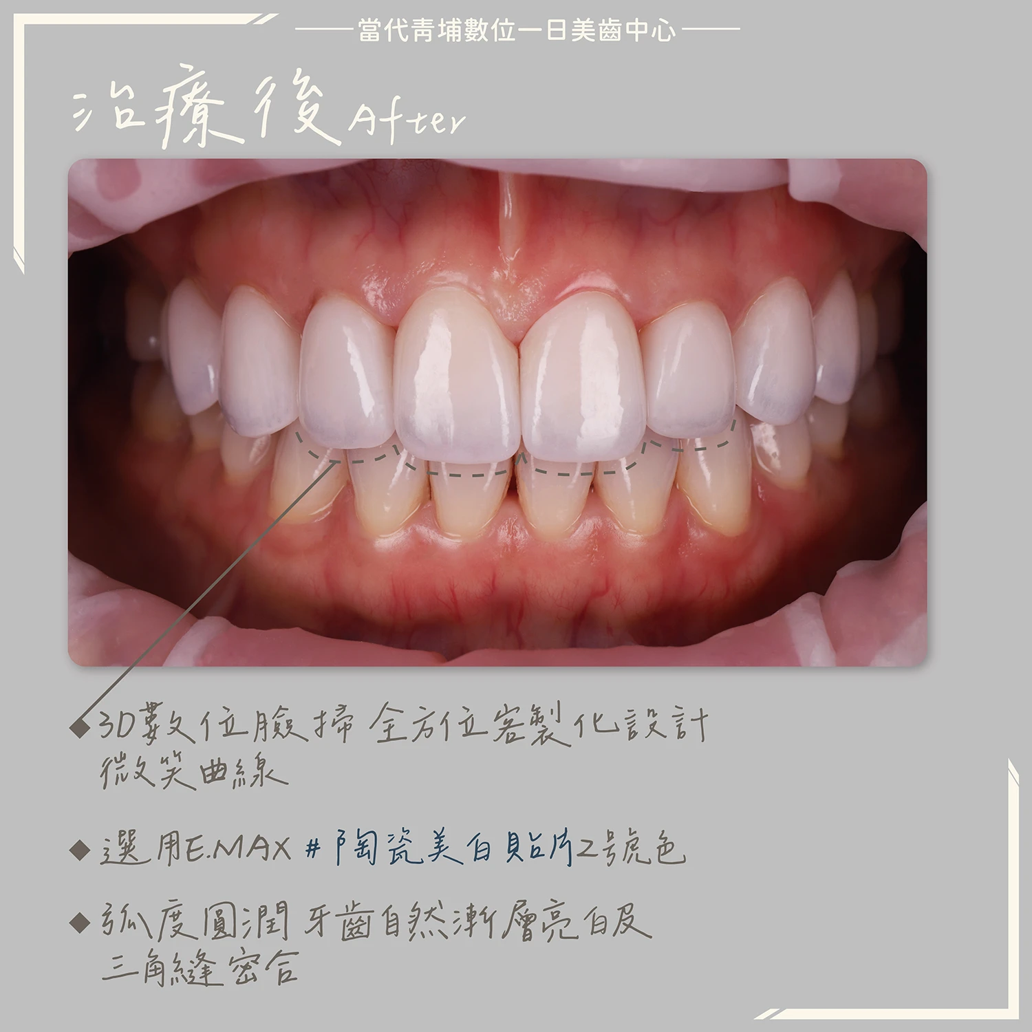 proimages/in-pro/pro-02/case-06.jpg proimages/四環黴素染色.jpg