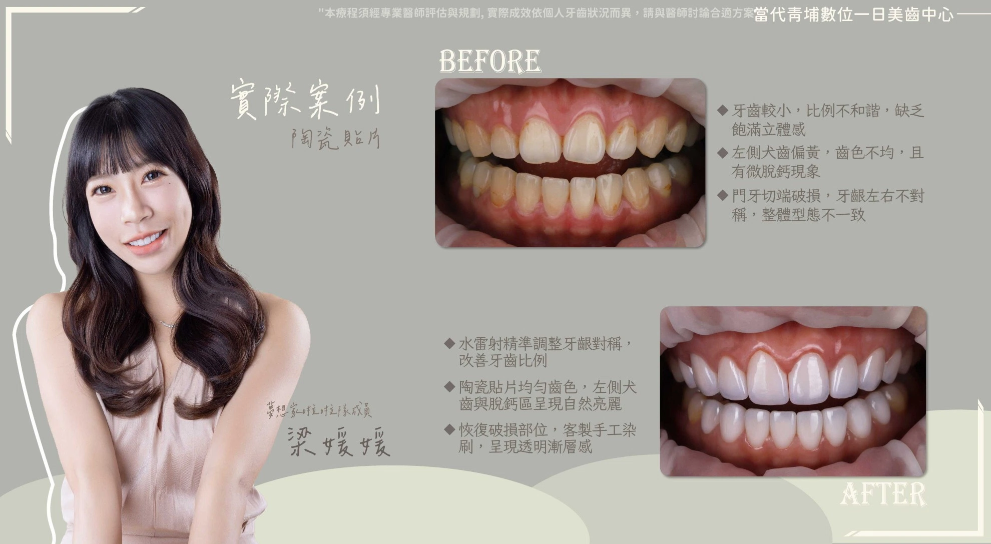 梁媛媛 | 聚光燈下魅力應援 梁媛媛 | 聚光燈下魅力應援