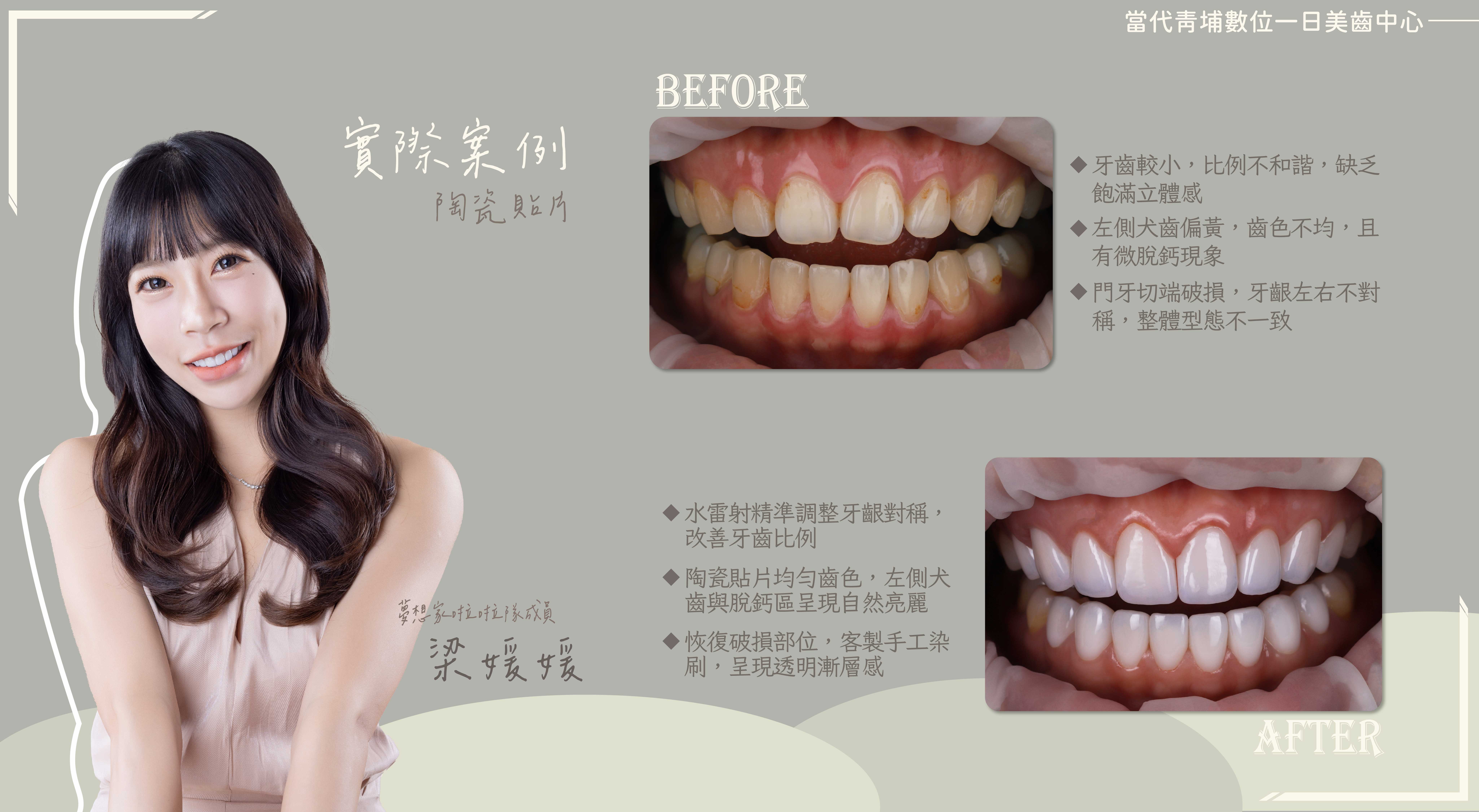 梁媛媛 | 聚光燈下魅力應援 梁媛媛 | 聚光燈下魅力應援