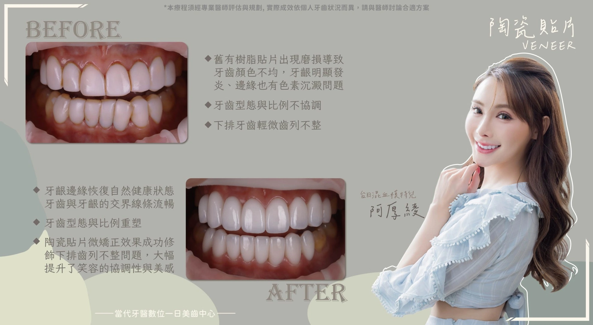 阿厚綾|樹脂貼片只是暫時的遮掩 阿厚綾|樹脂貼片只是暫時的遮掩