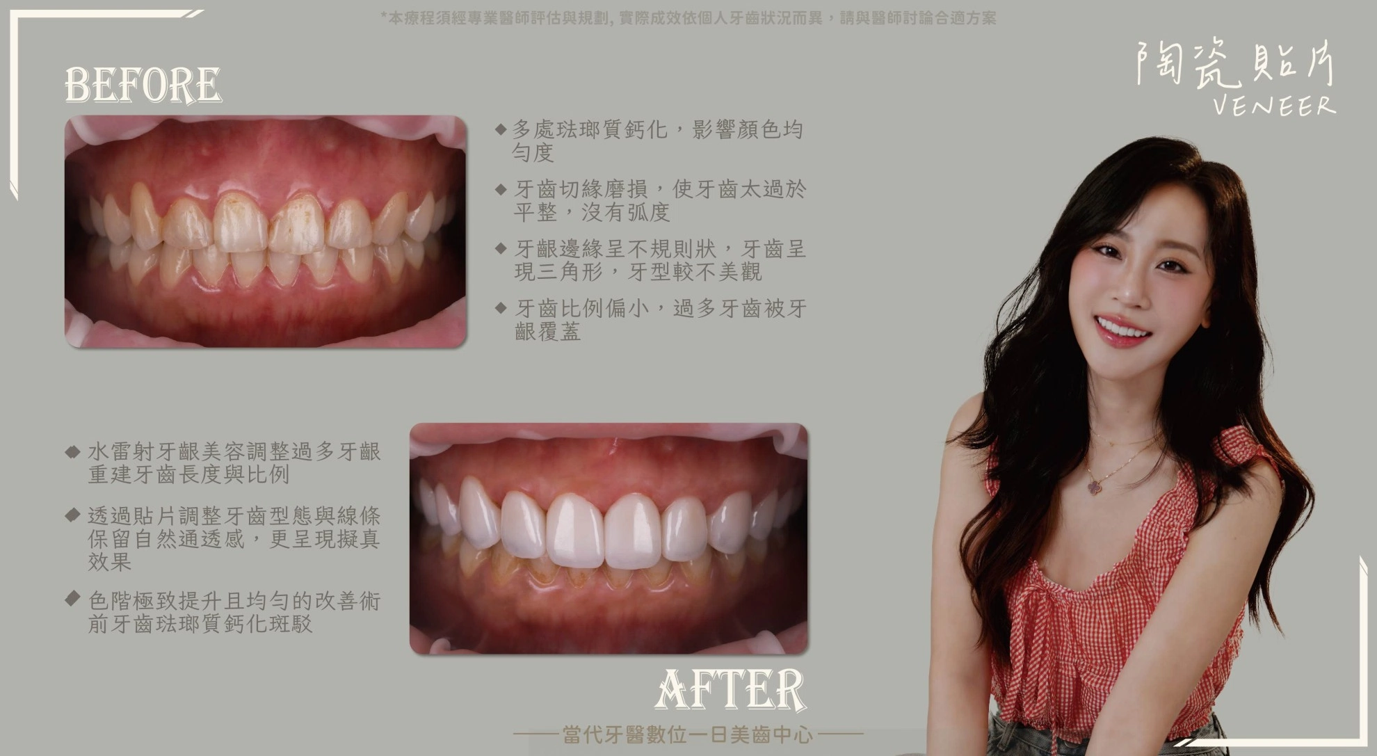 美齒諮詢師｜親自驗證每一個細節