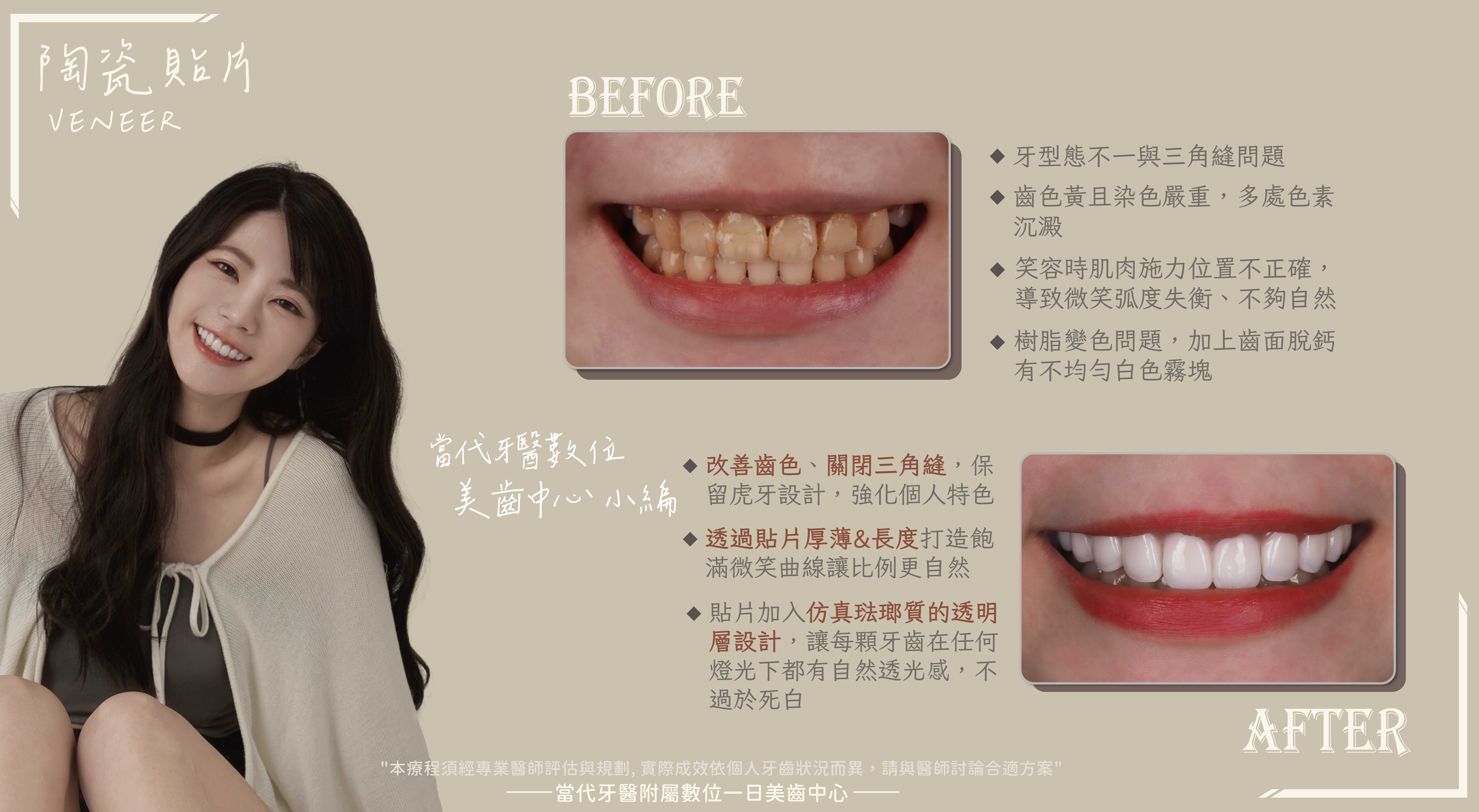 美齒小編 | 助理變主角,終於輪到我了 美齒小編 | 助理變主角,終於輪到我了