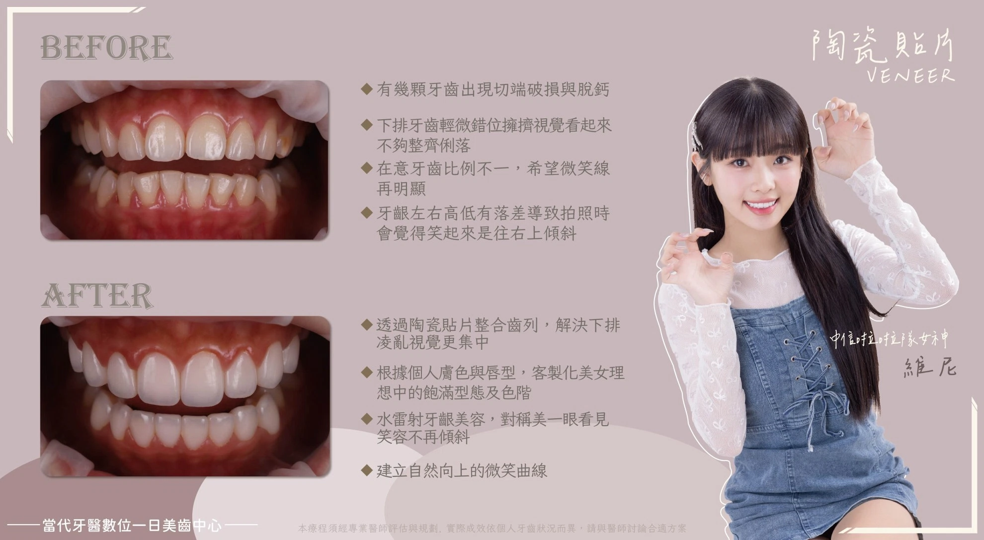 維尼｜愛笑的女生 笑容就是加分項