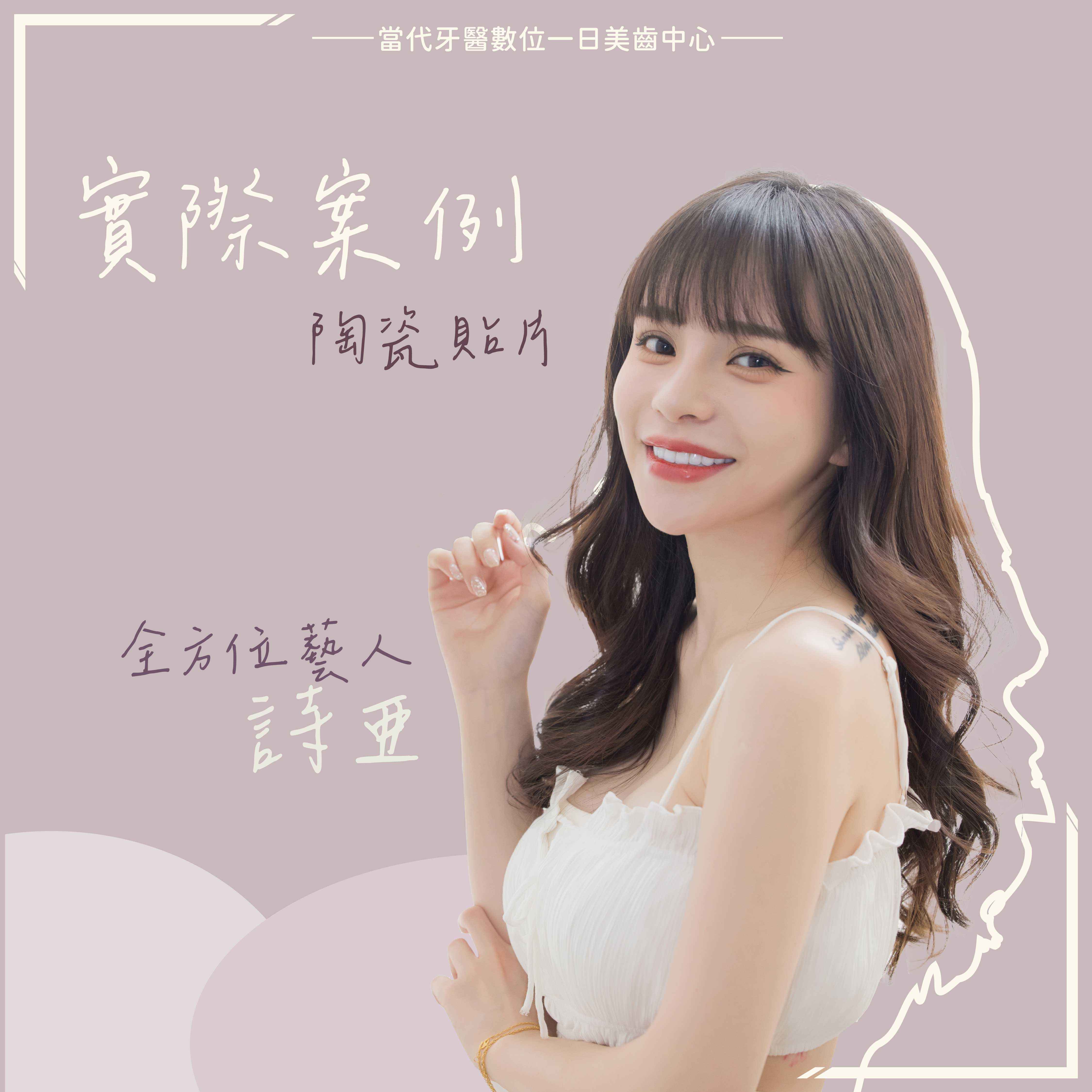 詩亞 | 都是獨一無二的存在 詩亞 | 都是獨一無二的存在
