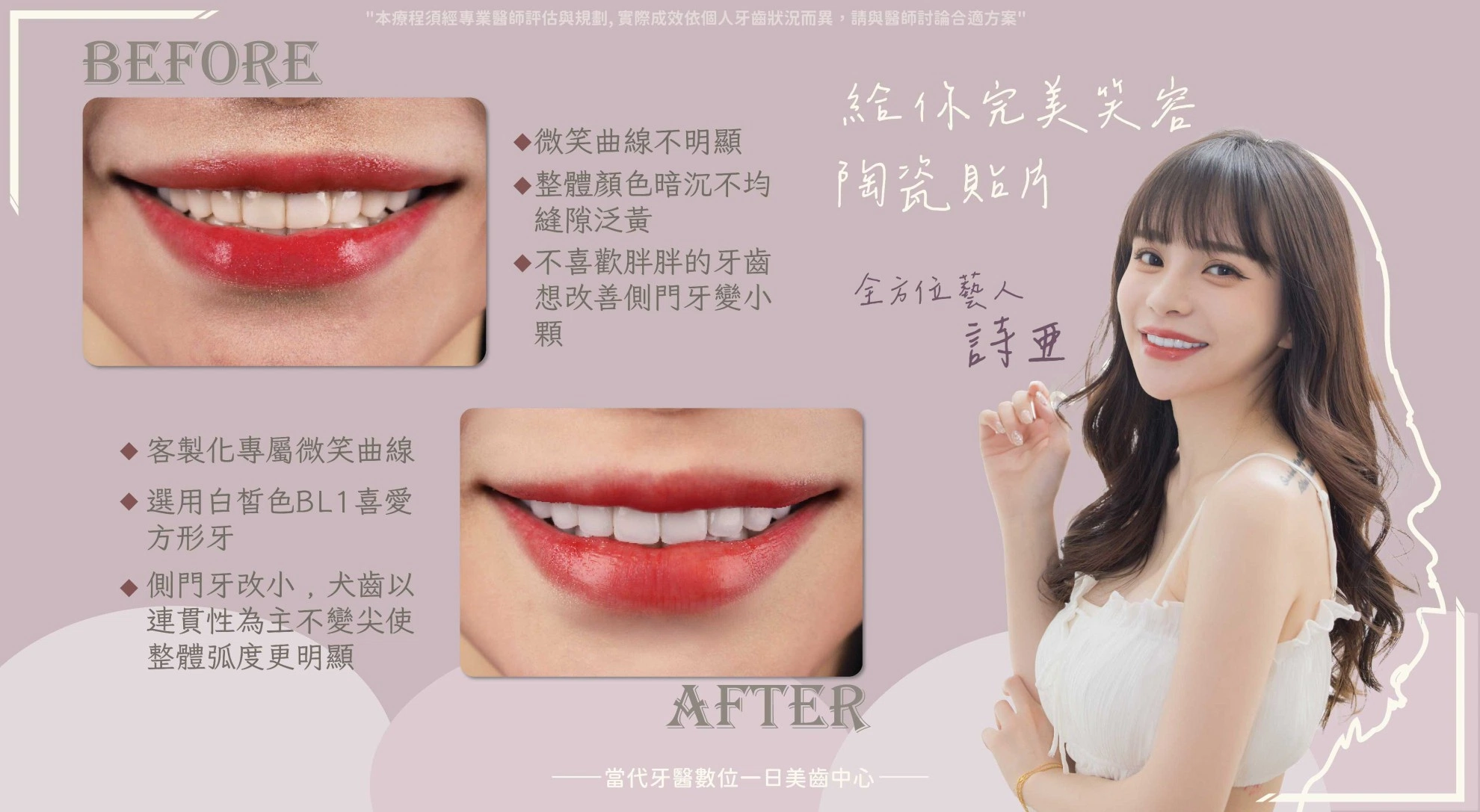 詩亞 | 都是獨一無二的存在 詩亞 | 都是獨一無二的存在