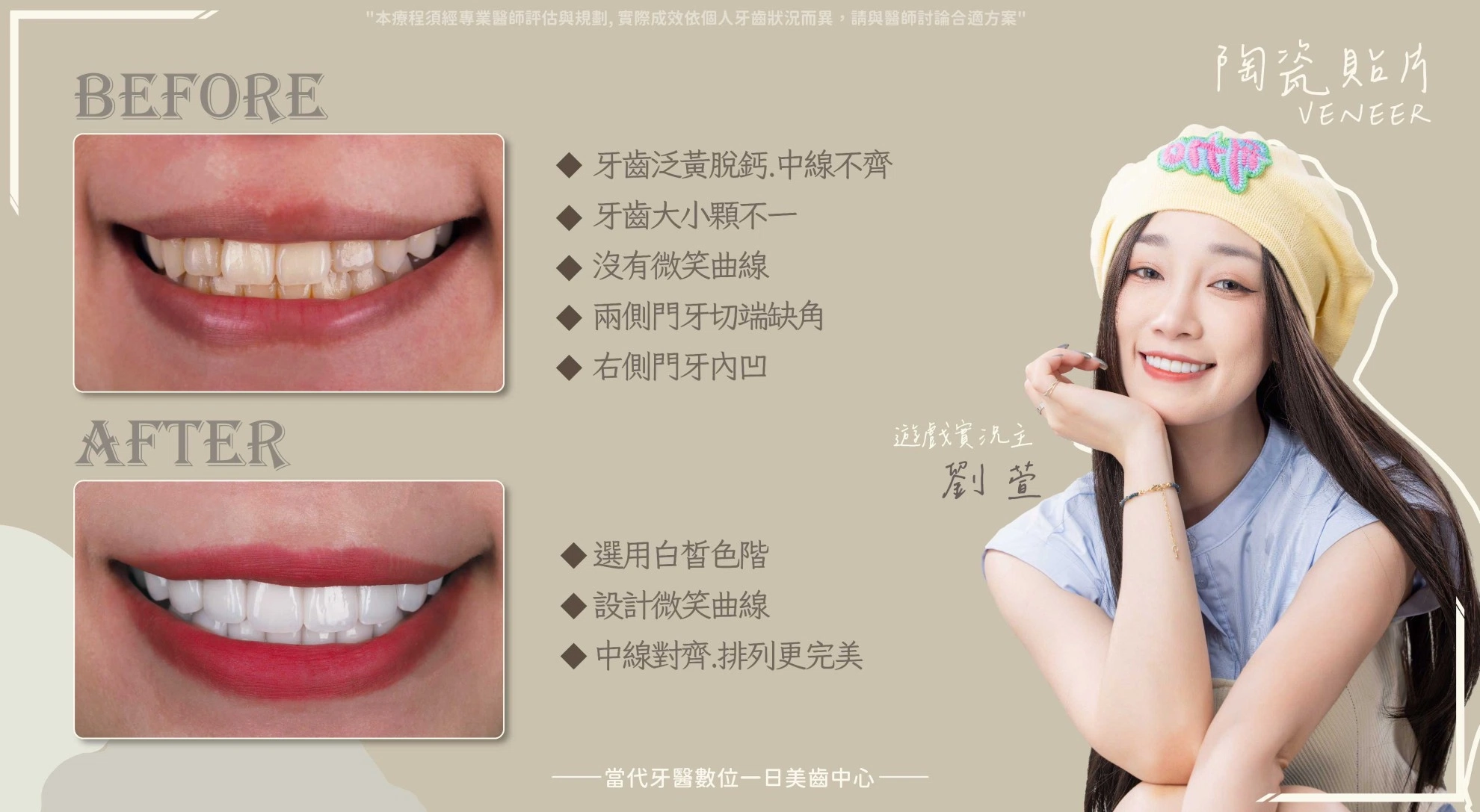 劉萱 | 陶瓷貼片每個職業都需要 劉萱 | 陶瓷貼片每個職業都需要