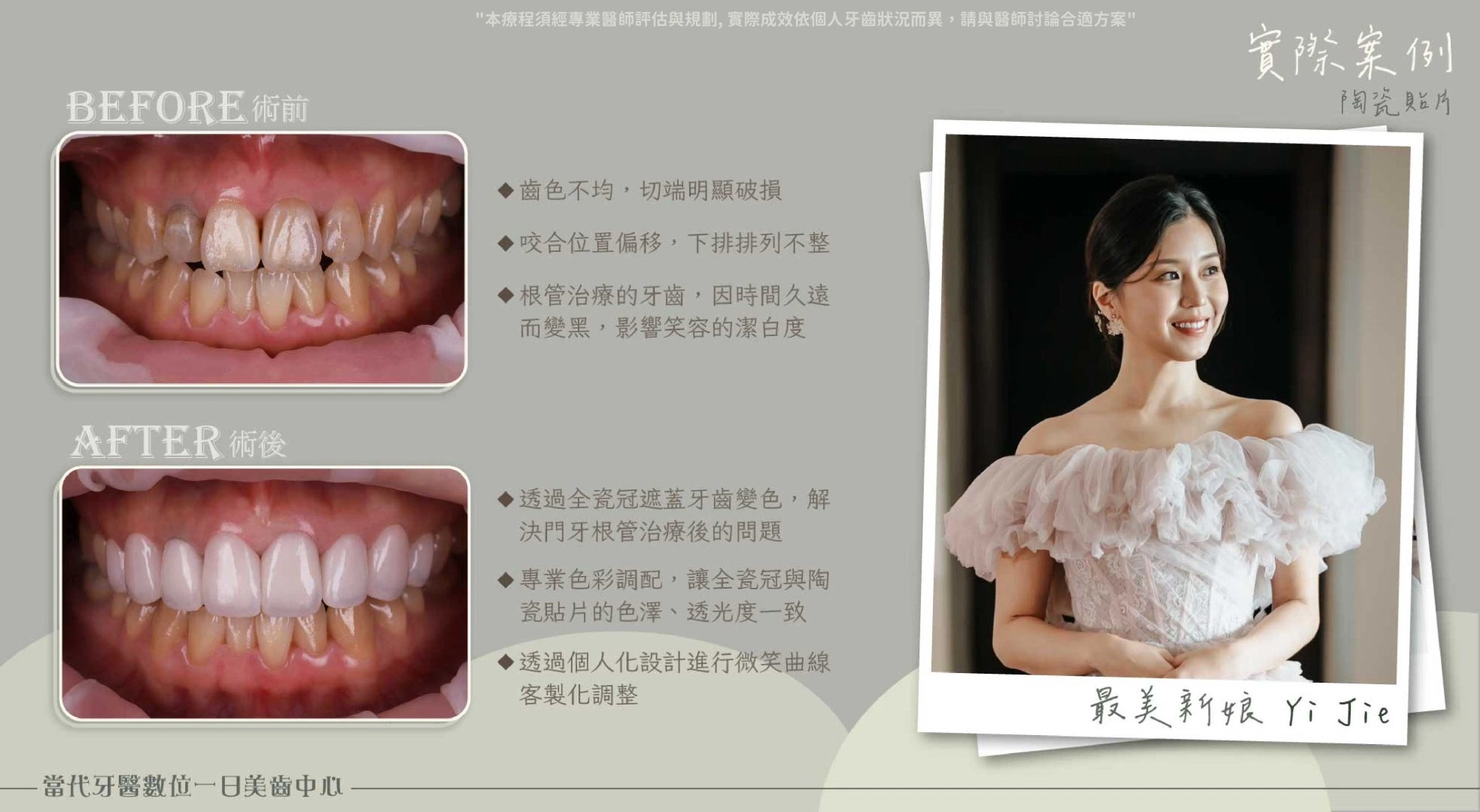 Yi Jie | 婚禮萬事俱備但牙齒還沒 Yi Jie | 婚禮萬事俱備但牙齒還沒