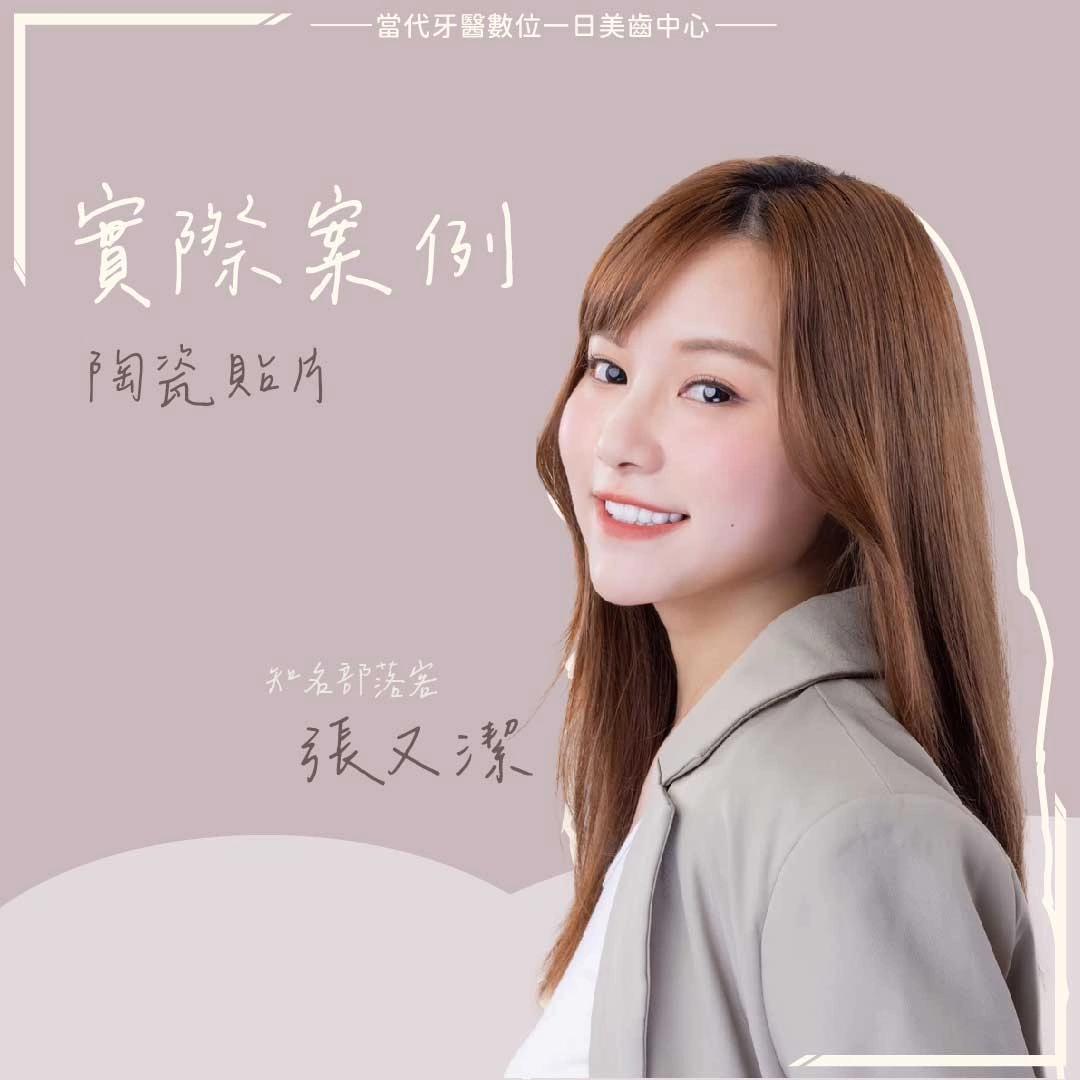 張又潔 |美的定義就是能做自己 張又潔 |美的定義就是能做自己