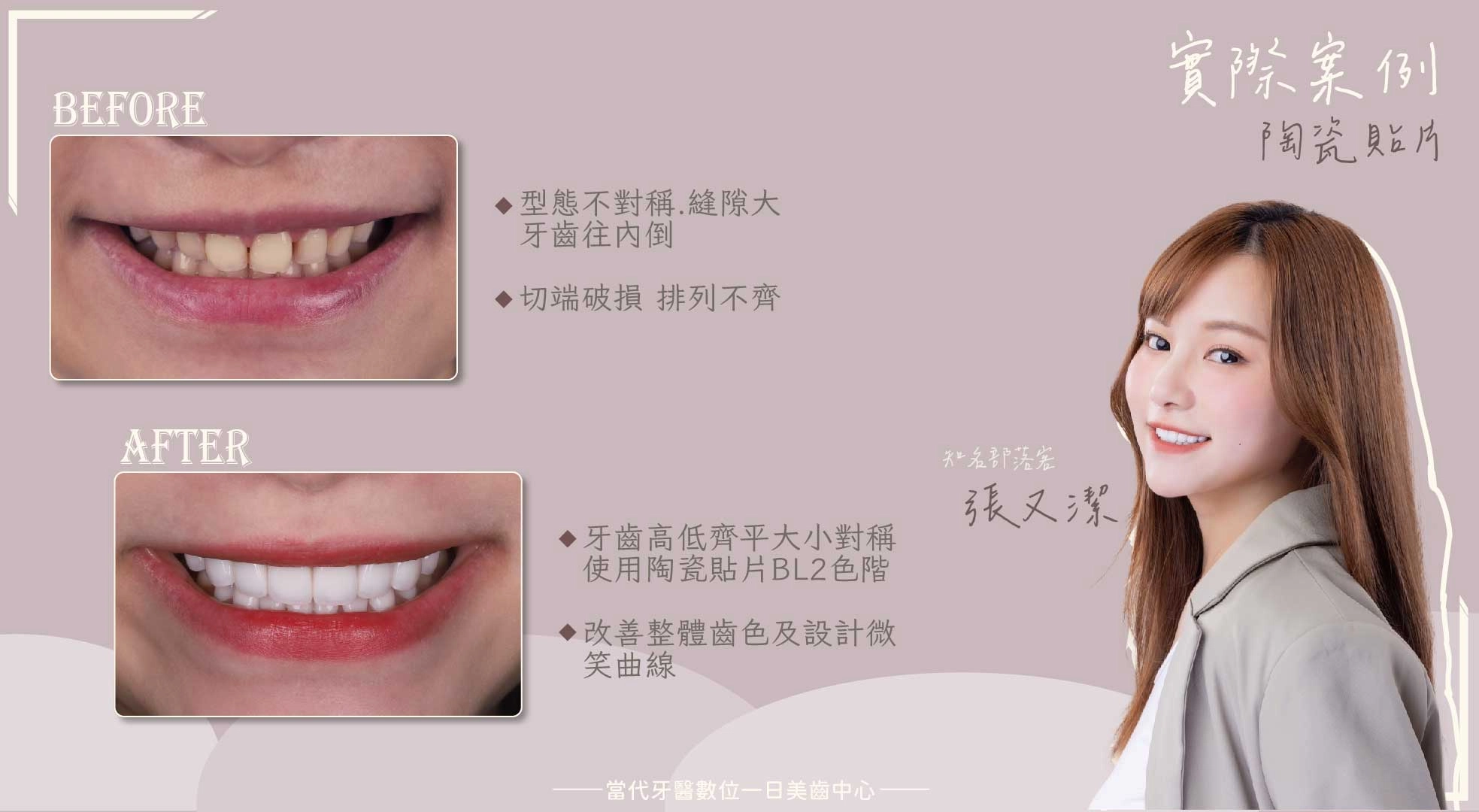 張又潔 |美的定義就是能做自己 張又潔 |美的定義就是能做自己
