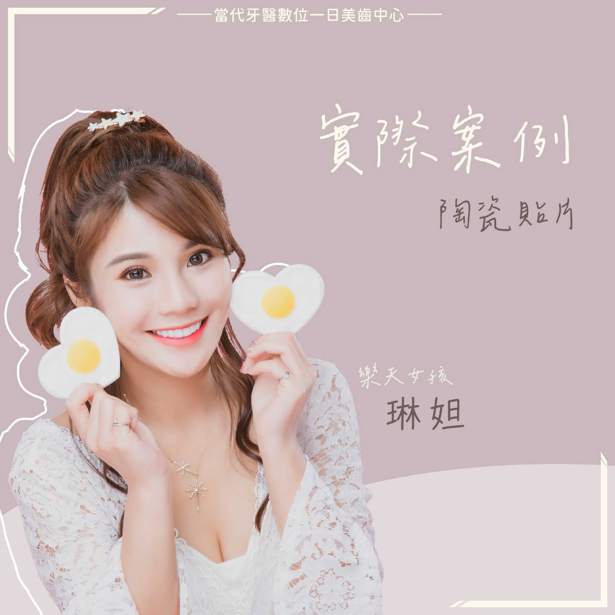 琳妲 | 貼片成為完美解方 琳妲 | 貼片成為完美解方