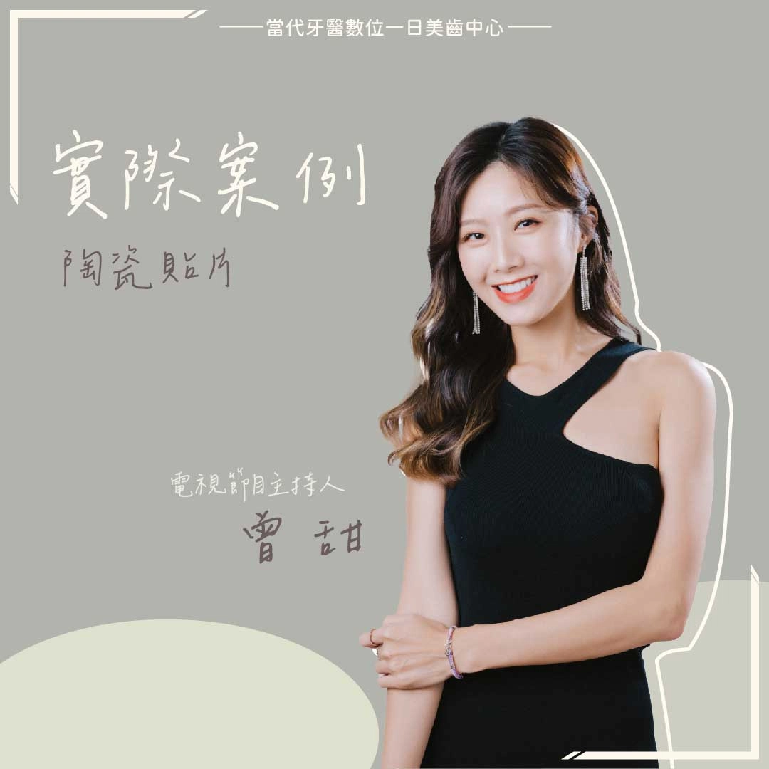 proimages/當代之星-琳妲網頁版-04.jpg 曾甜 | 重視自己的門面