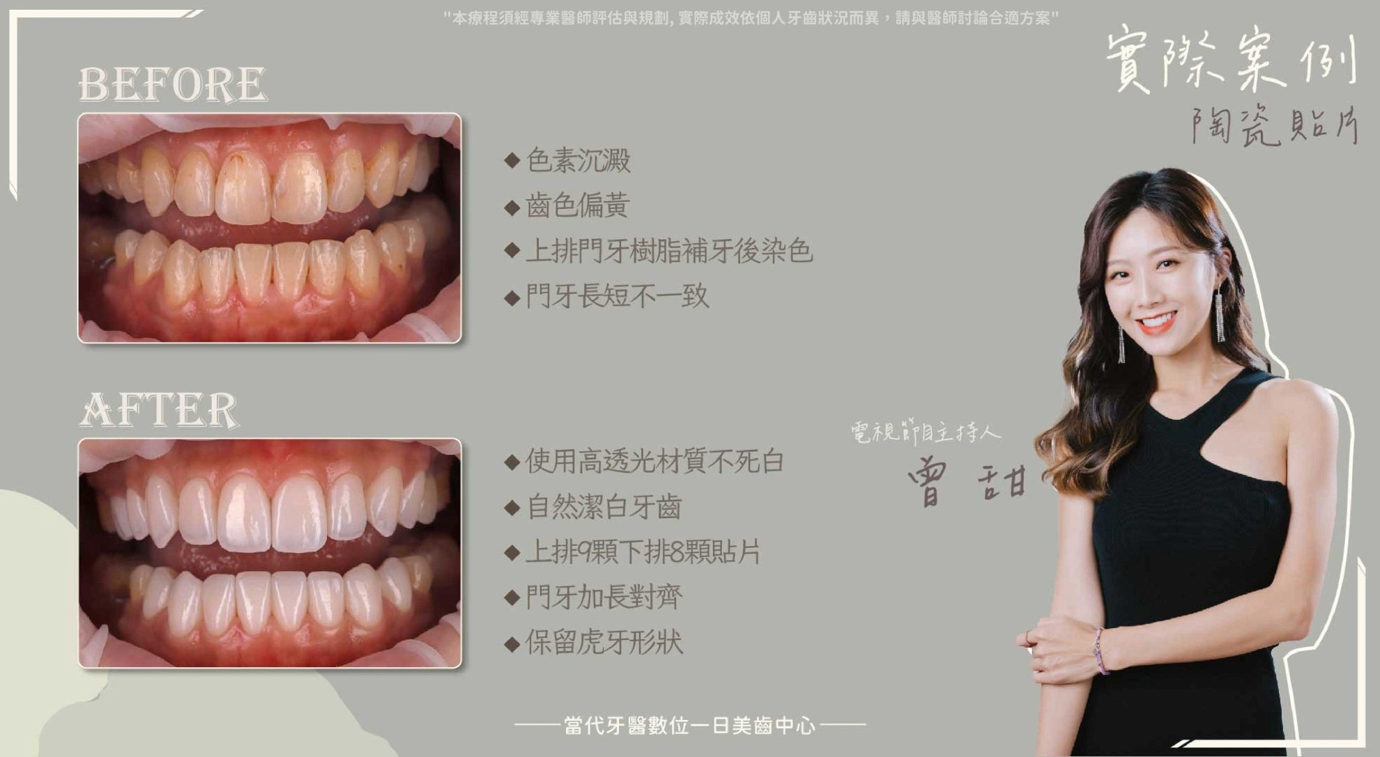 曾甜 | 重視自己的門面 曾甜 | 重視自己的門面