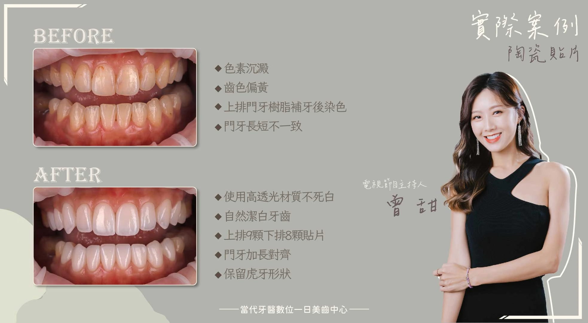 曾甜 | 重視自己的門面 曾甜 | 重視自己的門面