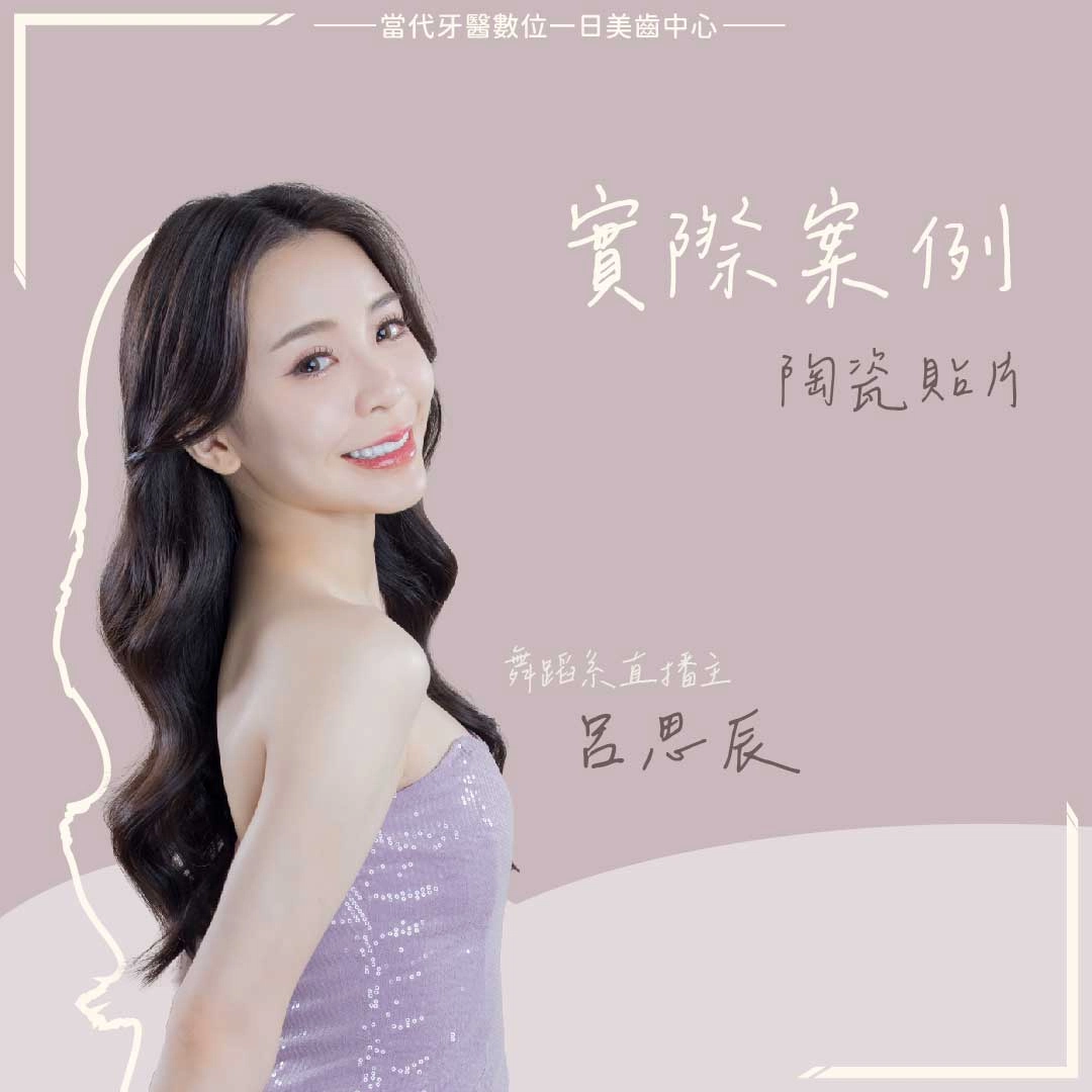 呂思辰 | 鏡頭前的自信從微笑開始 呂思辰 | 鏡頭前的自信從微笑開始
