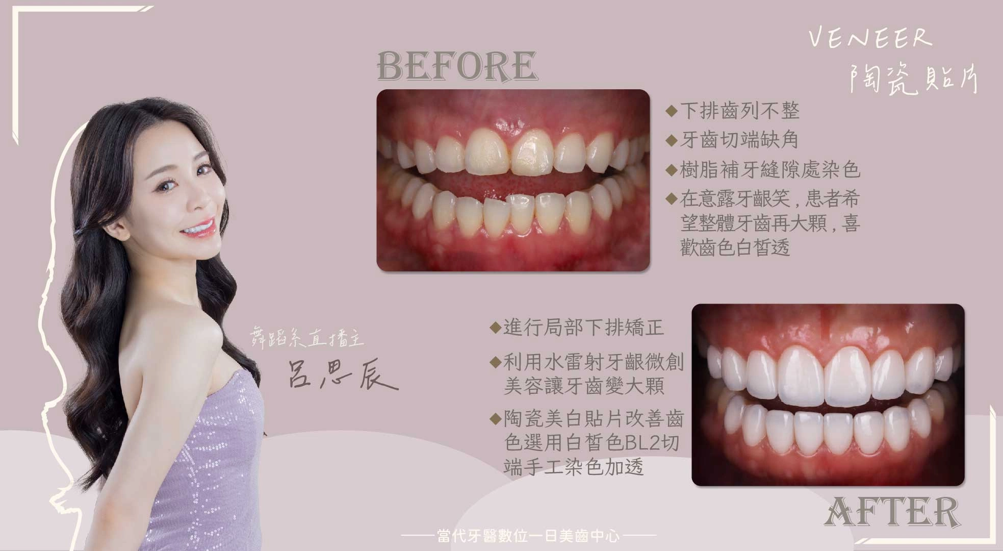 呂思辰 | 鏡頭前的自信從微笑開始 呂思辰 | 鏡頭前的自信從微笑開始