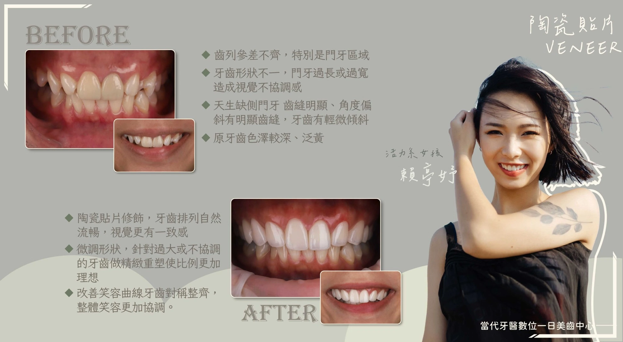 賴亭妤 | 天生缺牙做出來確很吸睛 賴亭妤 | 天生缺牙做出來確很吸睛