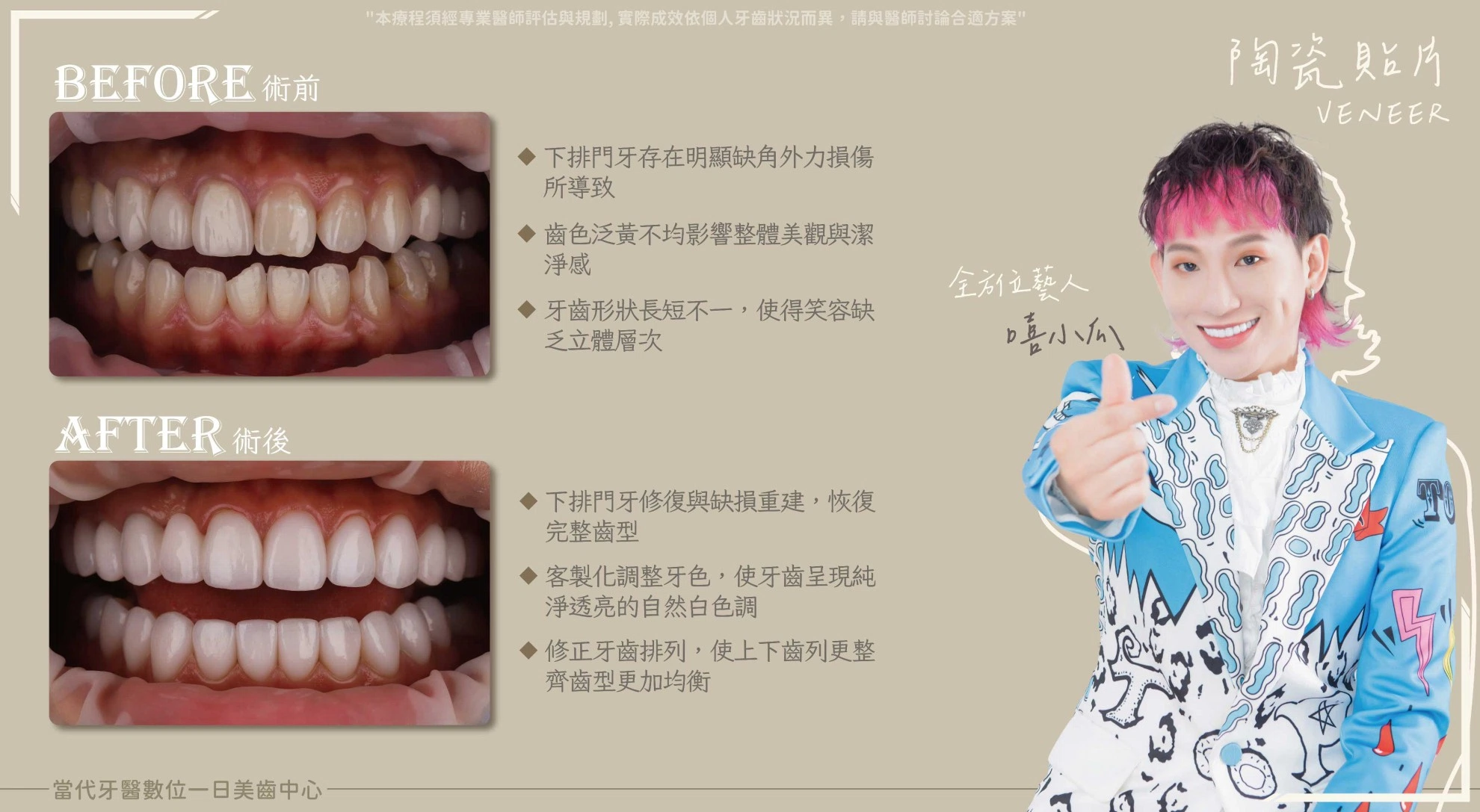 嘻小瓜 | 風格轉換共通點就是笑容 嘻小瓜 | 風格轉換共通點就是笑容