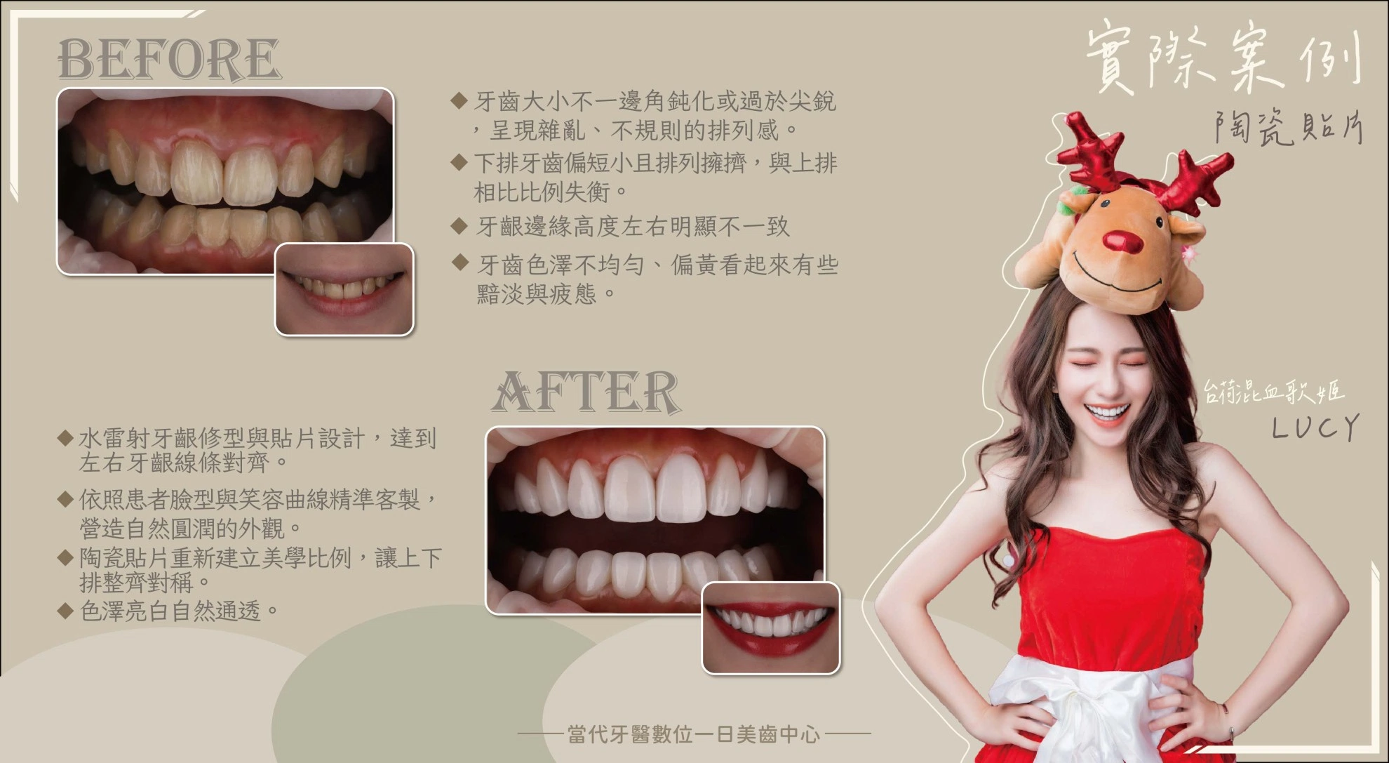 LUCY | 笑容不用修圖就能成真 LUCY | 笑容不用修圖就能成真