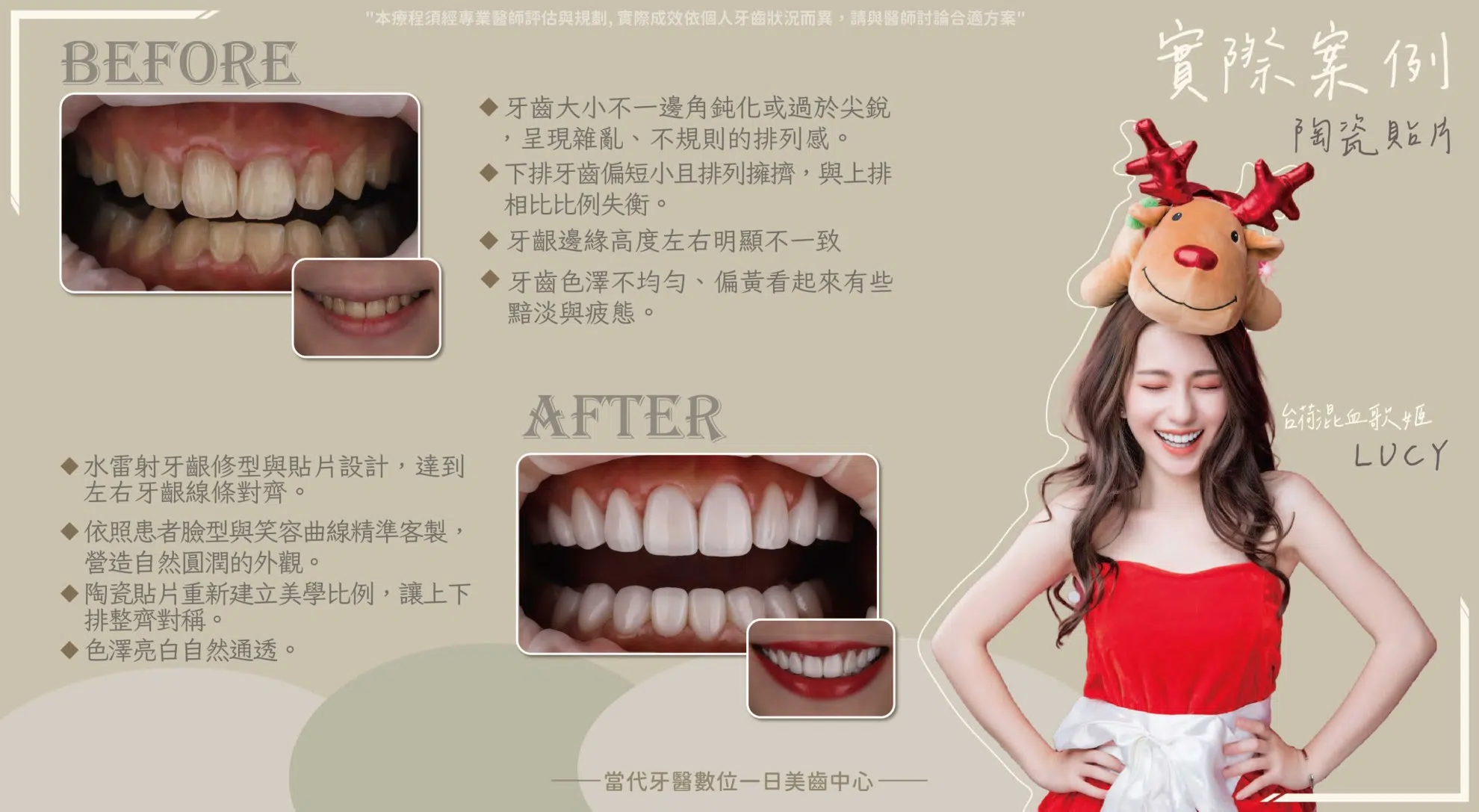 LUCY | 笑容不用修圖就能成真 LUCY | 笑容不用修圖就能成真