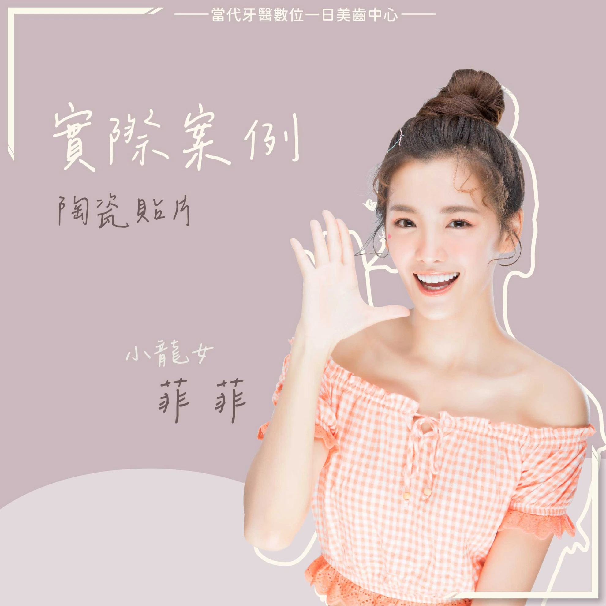 菲菲 |可樂果女孩到回眸女神 菲菲 |可樂果女孩到回眸女神