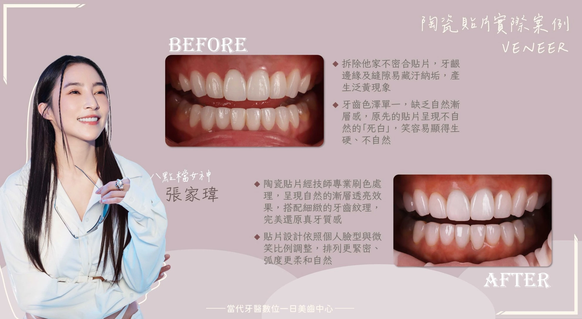 張家瑋 | 使用8年依然美觀整齊 張家瑋 | 使用8年依然美觀整齊