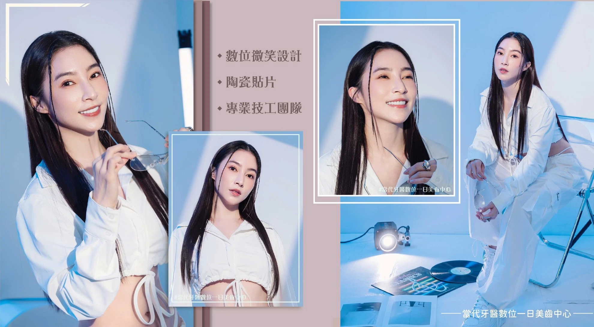 張家瑋 | 使用8年依然美觀整齊 (重做陶瓷貼片後,潔白明亮的自信笑容)