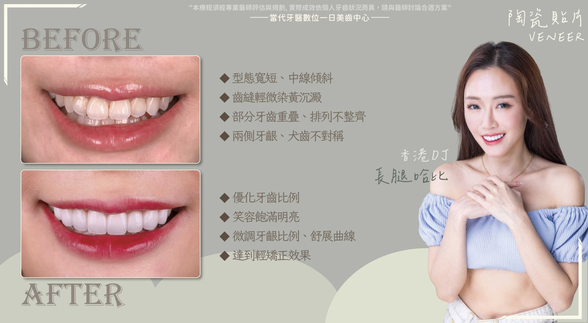 長腿哈比 | 最美的溝通無需翻譯 長腿哈比 | 最美的溝通無需翻譯