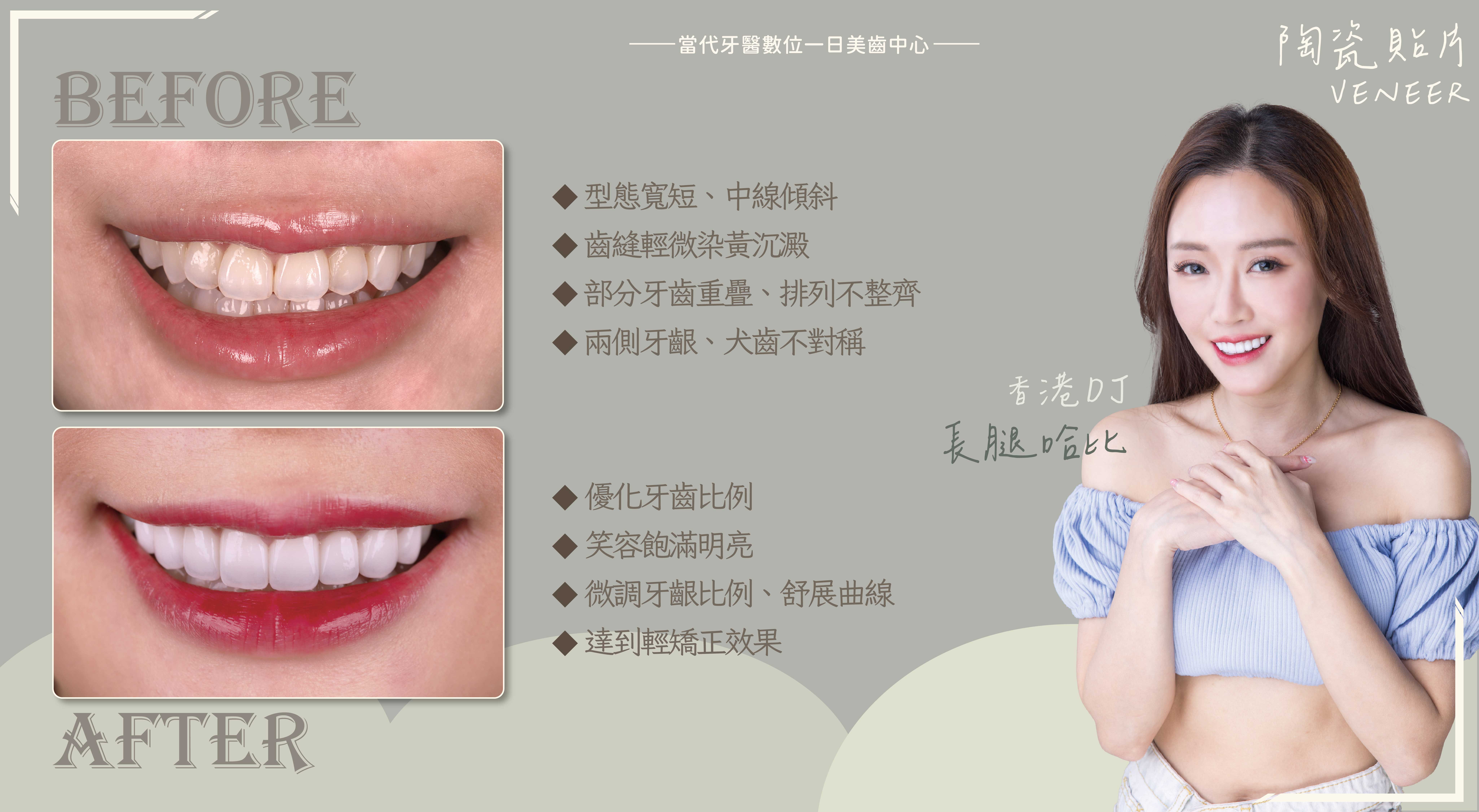 長腿哈比 | 最美的溝通無需翻譯 長腿哈比 | 最美的溝通無需翻譯