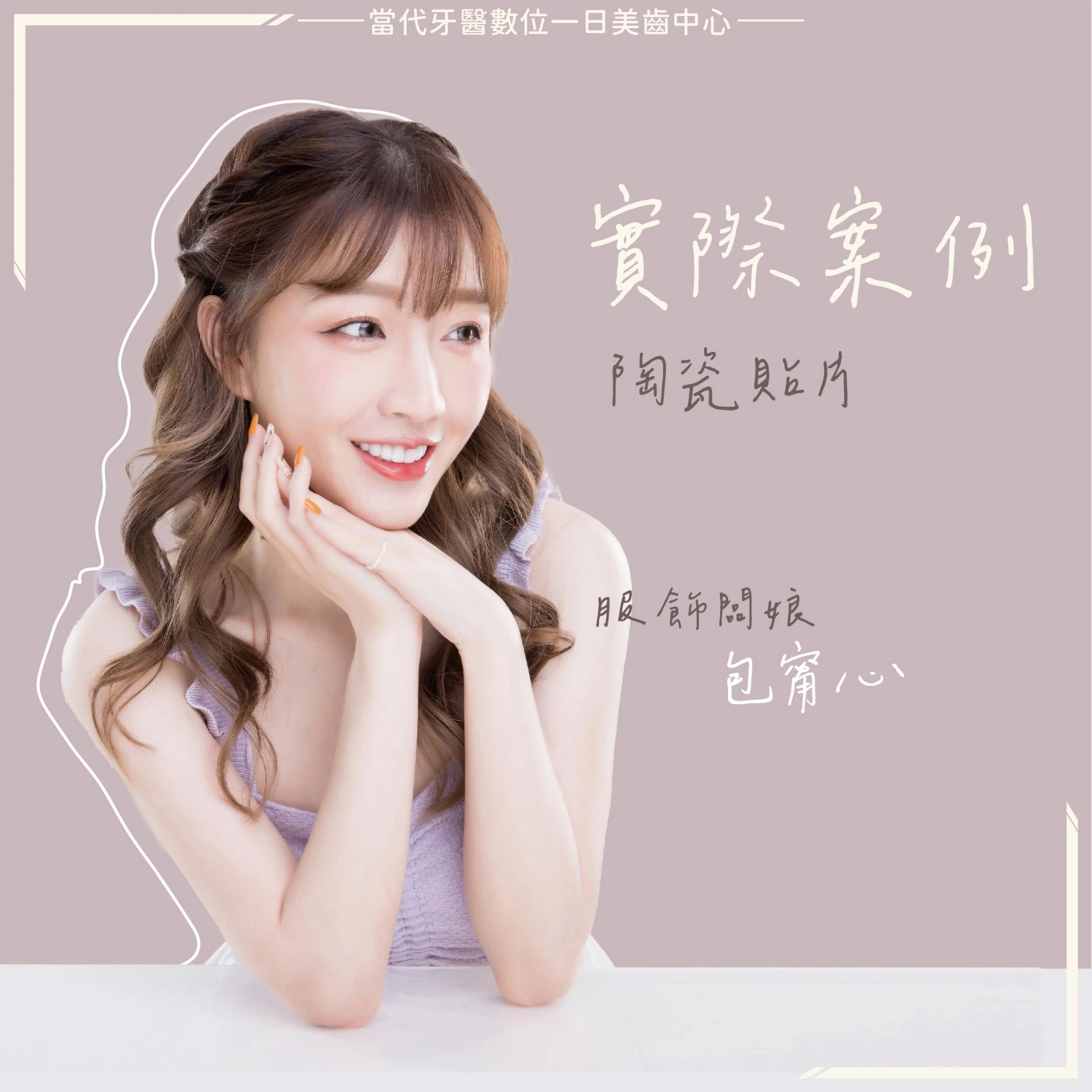 proimages/當代之星-琳妲網頁版-04.jpg proimages/當代之星-琳妲網頁版-04.jpg