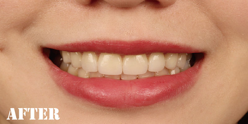 一日美學 一日美學