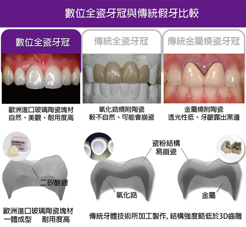 proimages/in-pro/pro-01/teeth.jpg proimages/in-pro/pro-01/teeth.jpg